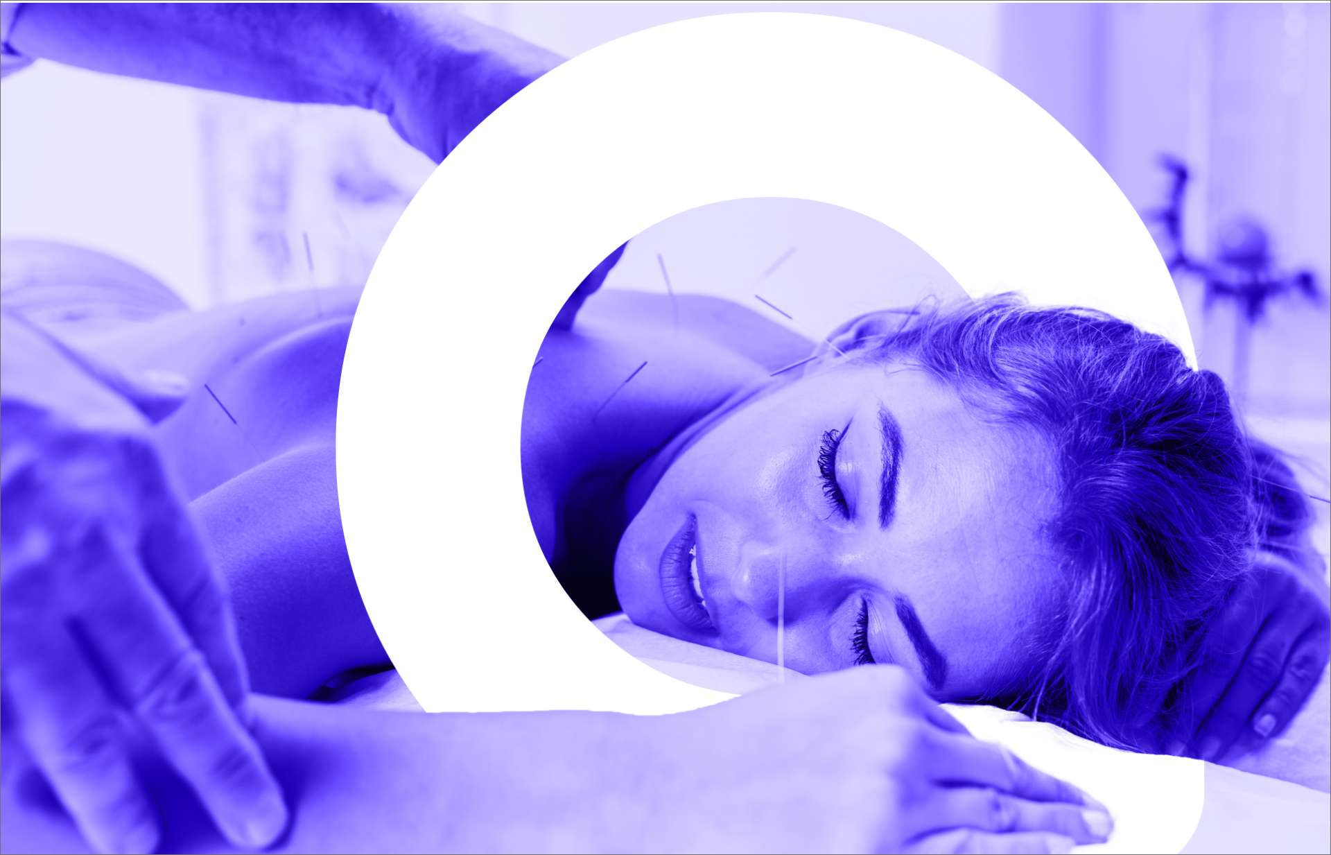 Reasons to Consider Acupuncture Treatment | Elysian Wellness