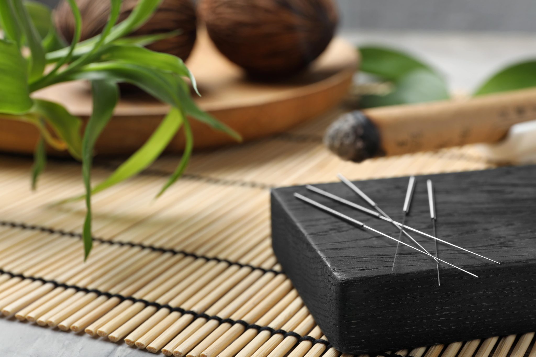 Exploring Acupuncture: Ancient Practice with Modern Benefits