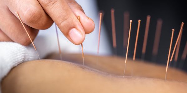 acupuncture needs in skin